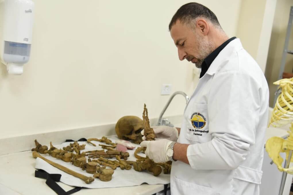 Antropología forense